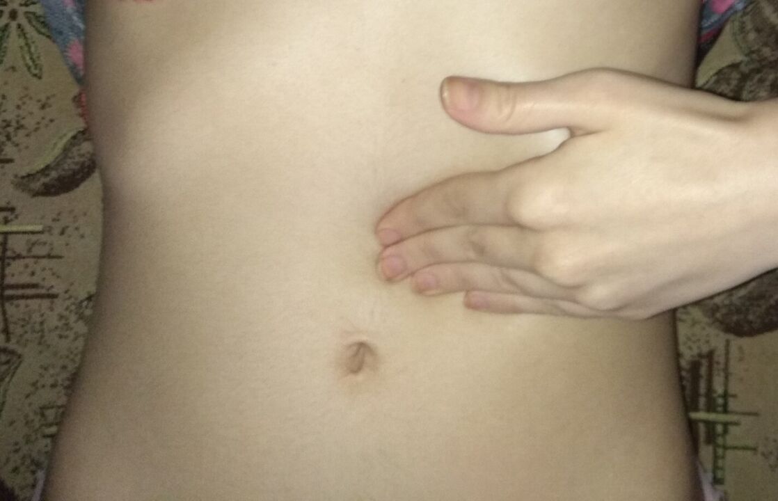 Veselīgs vēders pēc ārstēšanas ar NEOflorax kapsulām