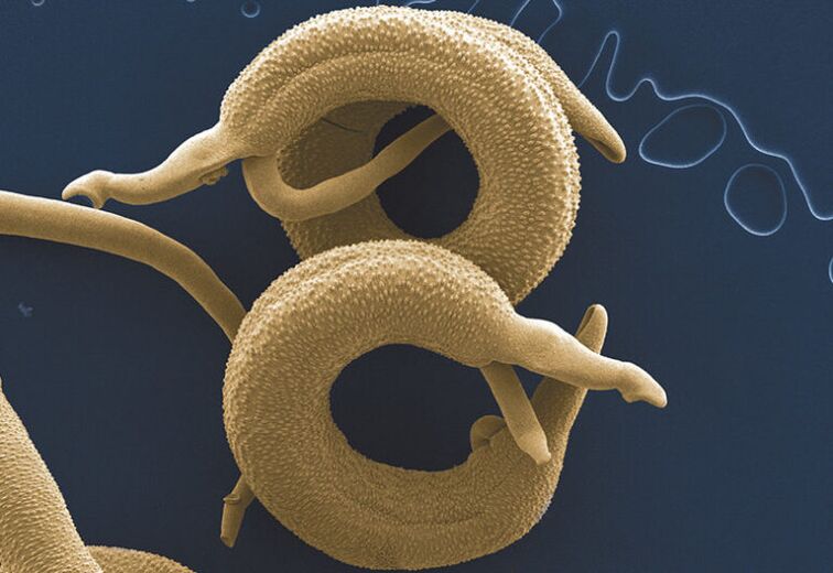 parazīti, kas dzīvo cilvēka organismā